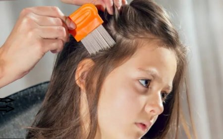 What Does Dreaming of Lice Mean? A Western Psychological Reading - Freud, Jung, Adler