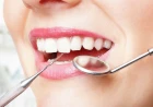 Teeth Dreams in Islam: Family, Lifespan, Loss and Relief Explained