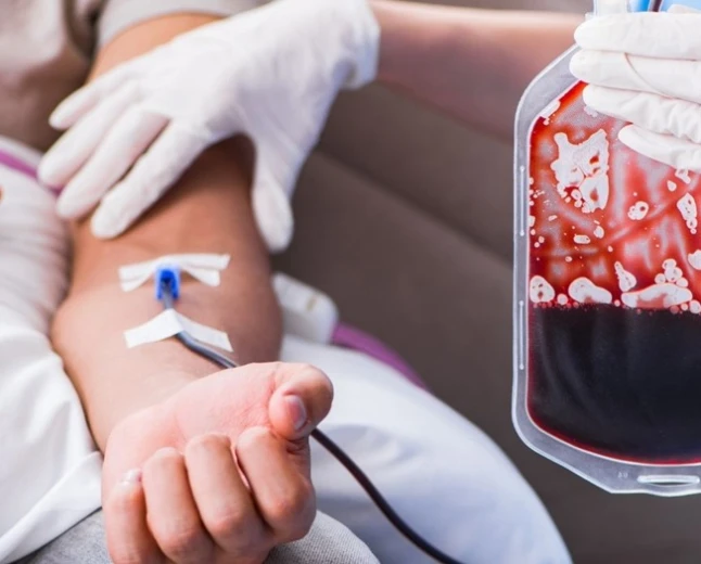 Seeing blood in a dream: Islamic scholars explain hidden meanings